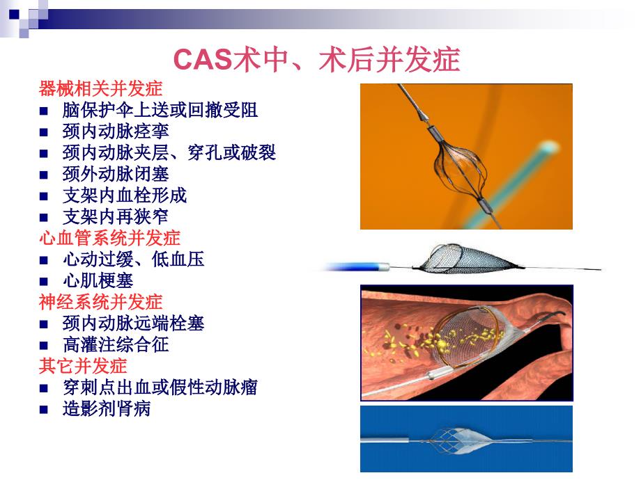 颈动脉支架研究及常见并发症_第3页