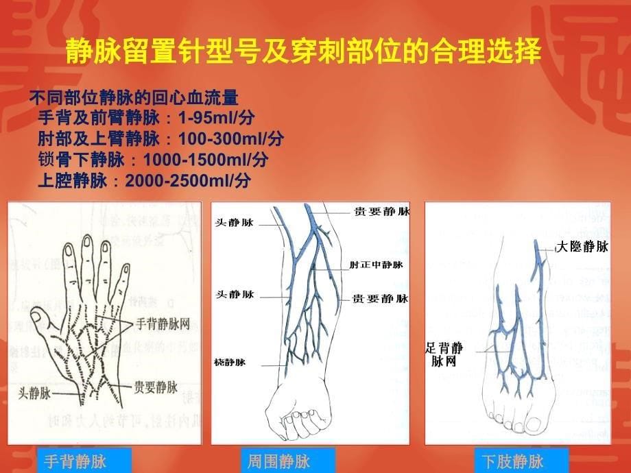 医学静脉留置针培训专题培训课件_第5页