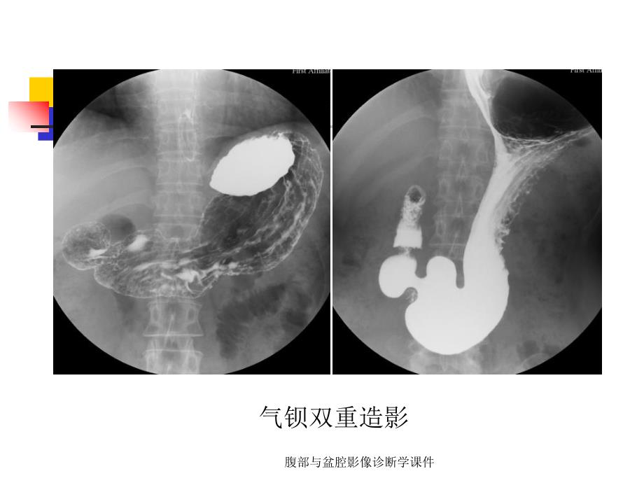 腹部与盆腔影像诊断学课件_第4页