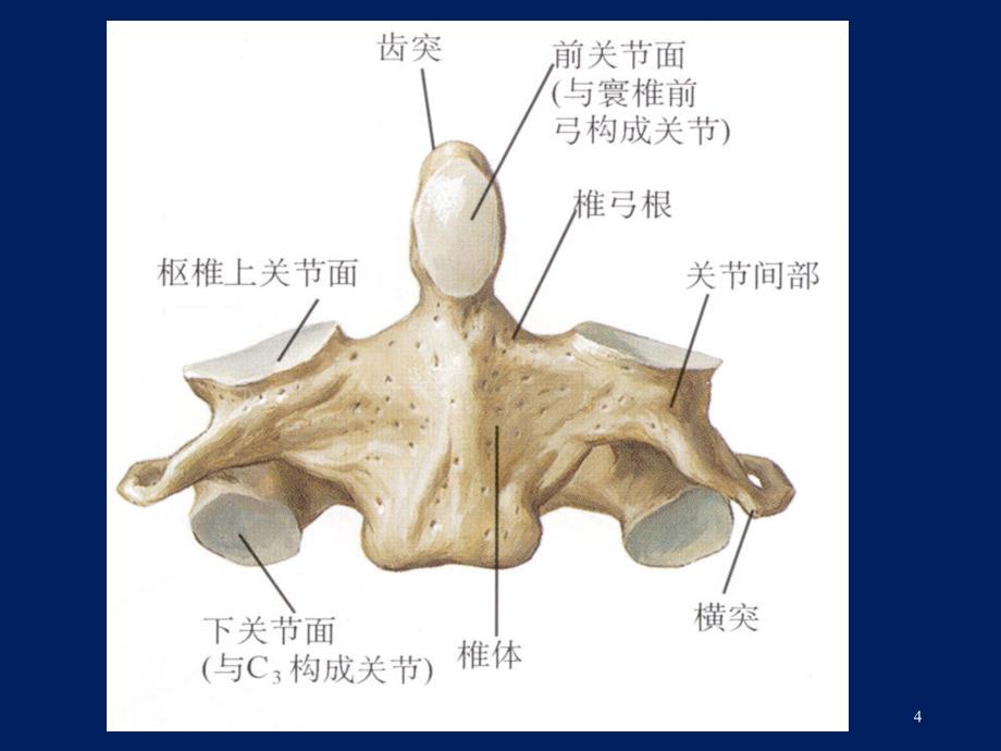 齿突骨折ppt课件_第4页