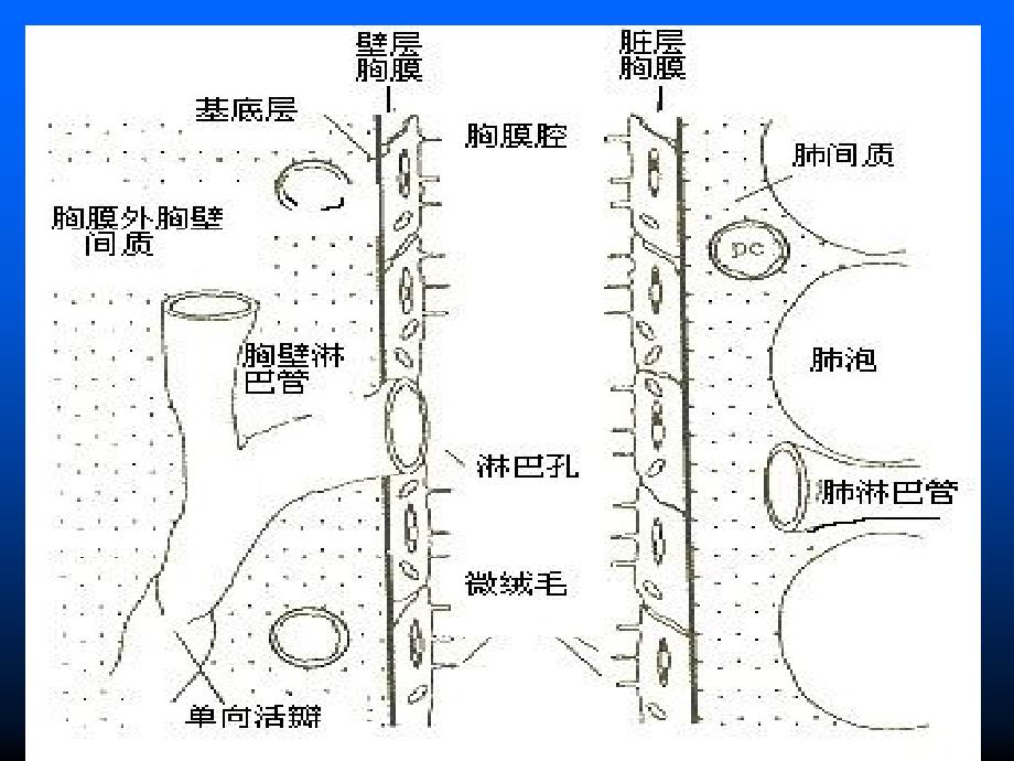 恶性胸腔积液的诊断治疗_第5页