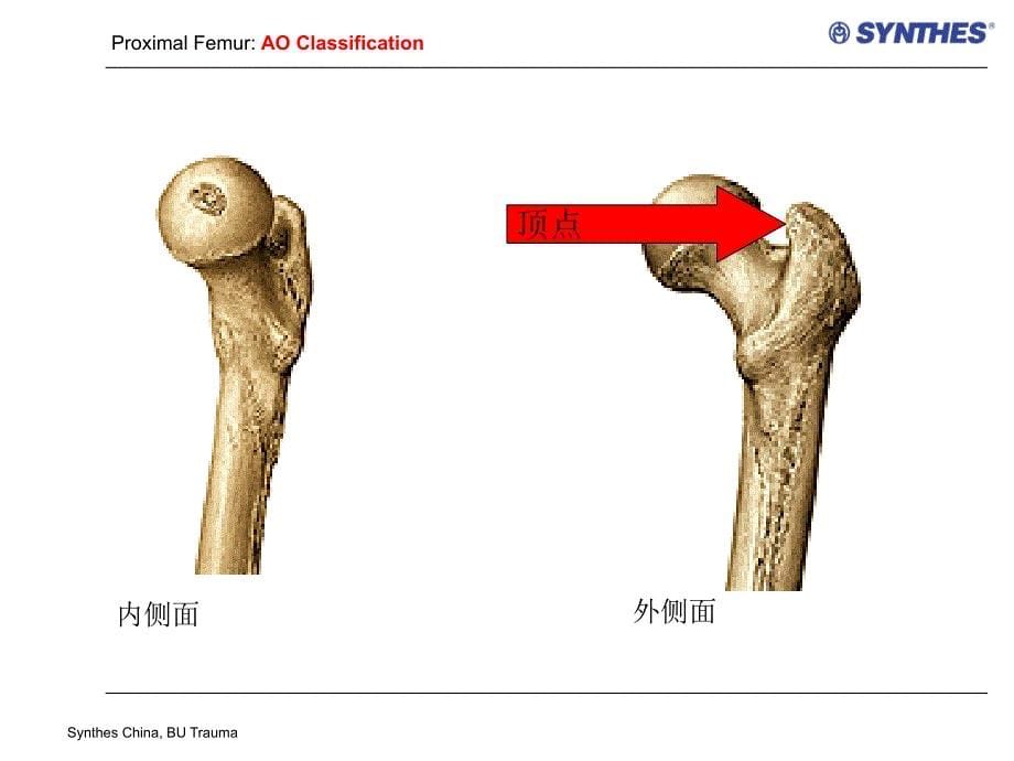 pfn操作技术PPT课件_第5页