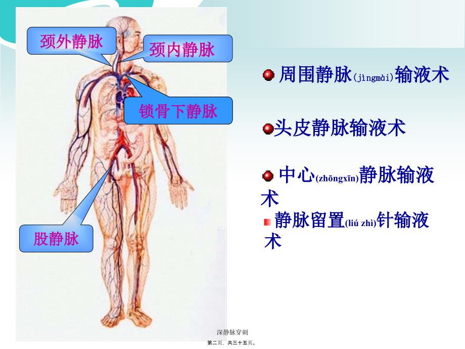 深静脉穿刺课件_第2页