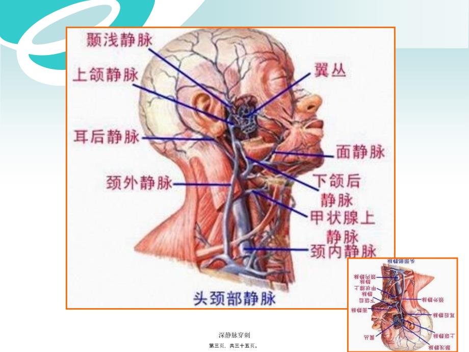 深静脉穿刺课件_第3页