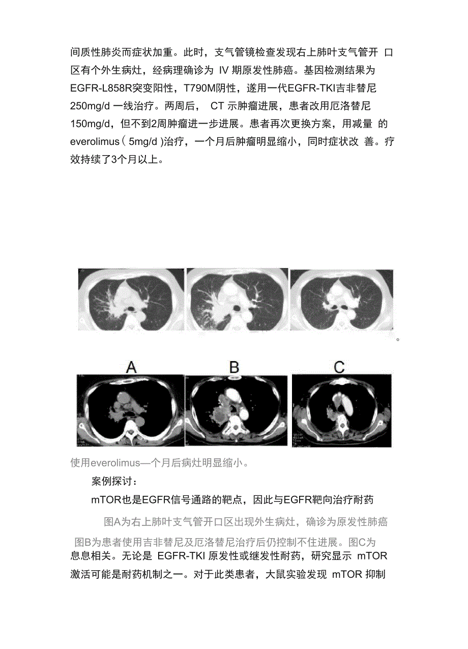 横扫六大癌种PI3K抑制剂开启“异病同治”精准治疗时代_第3页