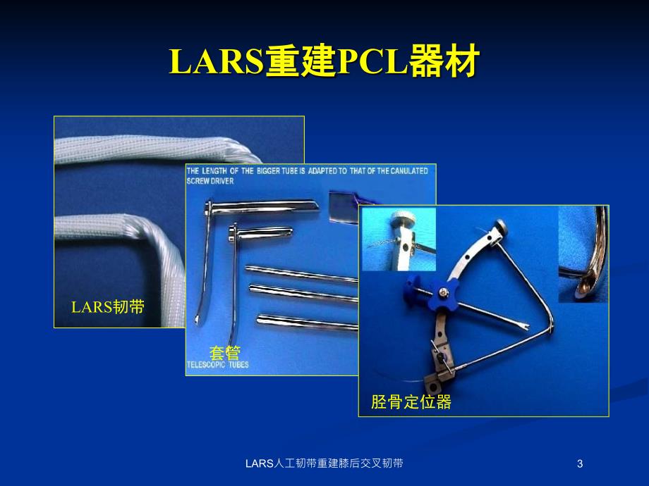 LARS人工韧带重建膝后交叉韧带培训课件_第3页