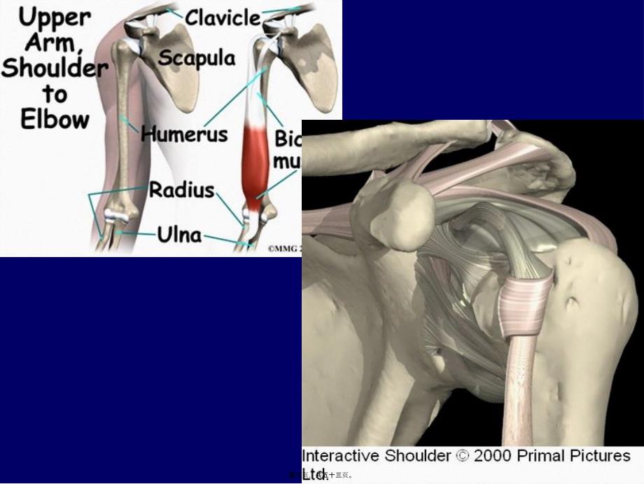 医学专题—肱二头肌肌腱炎、断裂_第3页