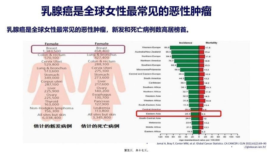 乳腺癌流行病学分析8137_第5页