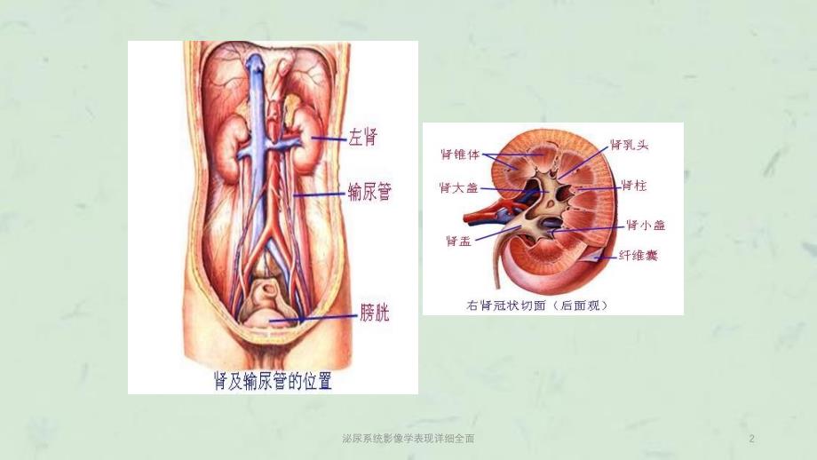 泌尿系统影像学表现详细全面课件_第2页