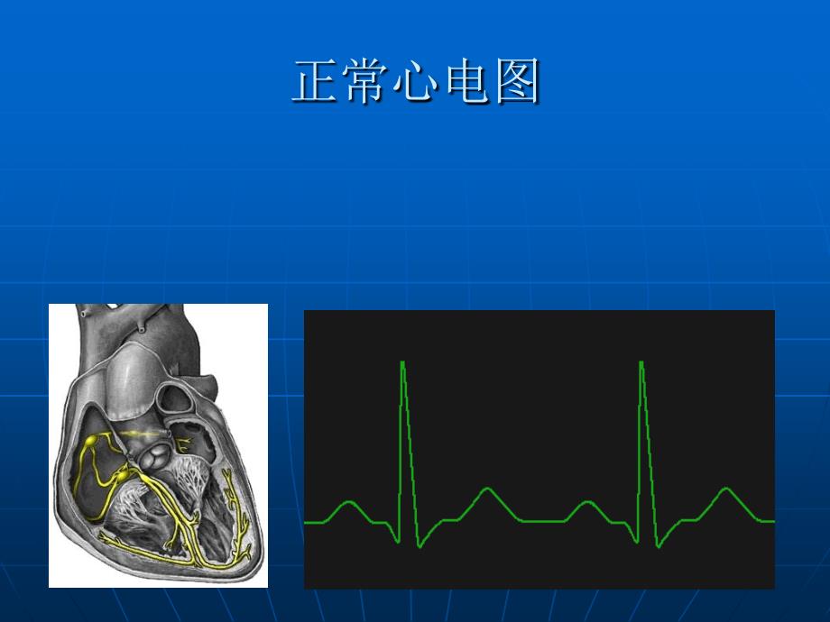 恶性心律失常的识别医学_第2页