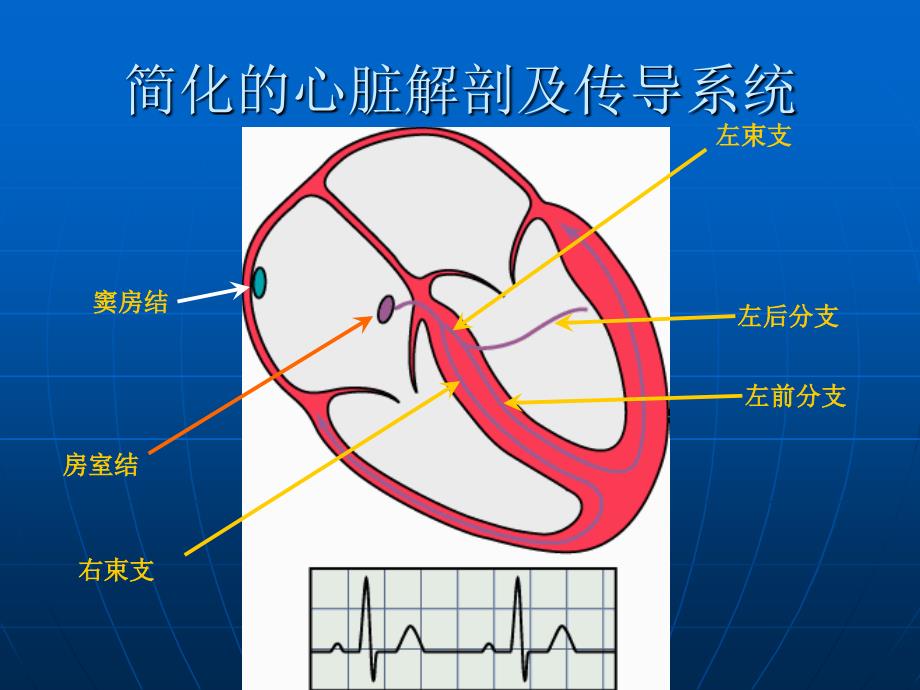 恶性心律失常的识别医学_第3页