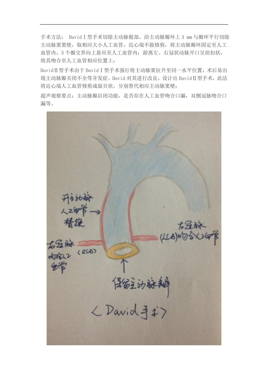 主动脉根部病变的常见外科术式_第3页