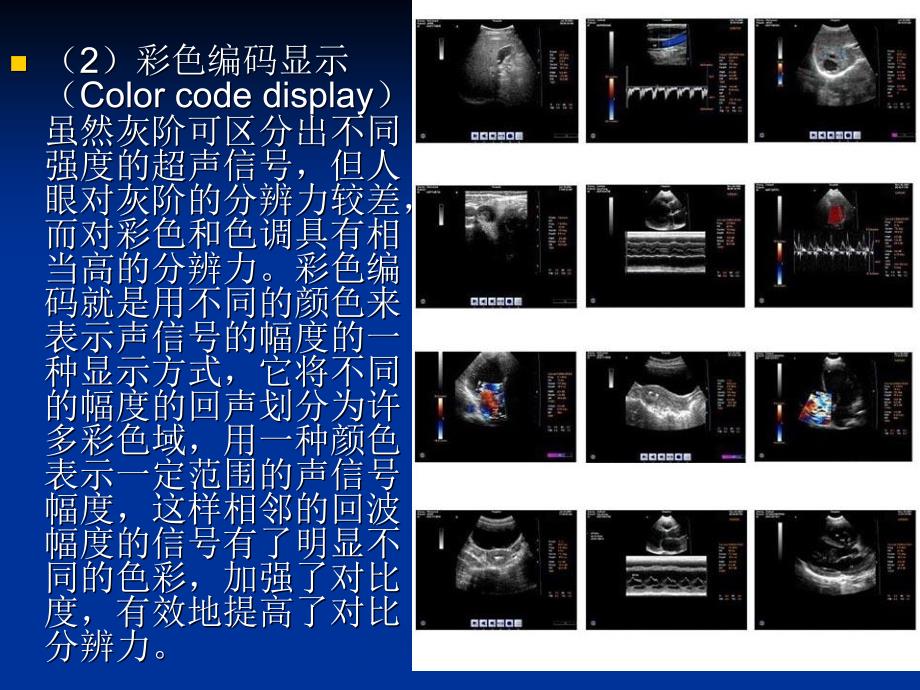 解读B超报告基础知识_第4页