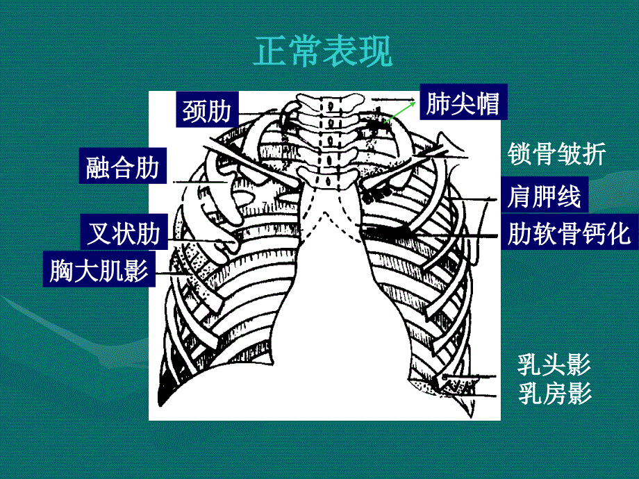 医学影像系列讲座.ppt_第4页