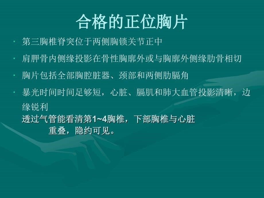 医学影像系列讲座.ppt_第5页