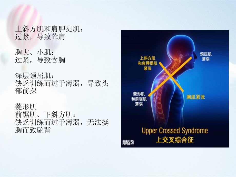 上交叉综合征_第4页