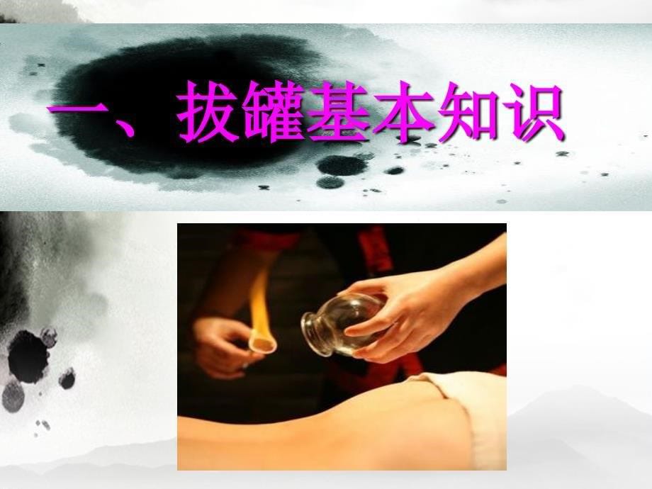 健康工具包拔罐.ppt_第5页