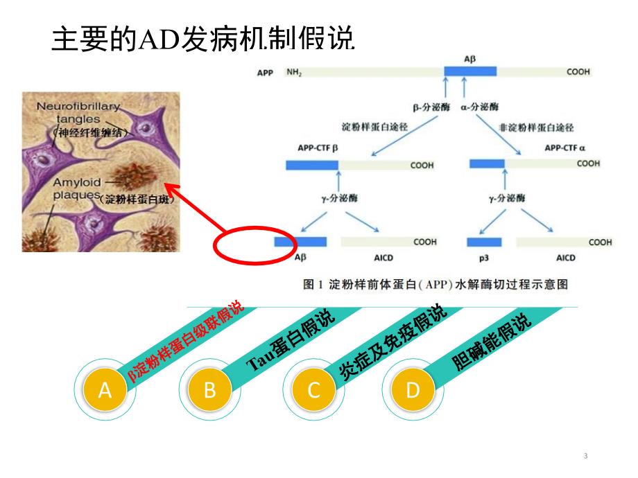 阿尔茨海默防治策略ppt演示课件_第3页