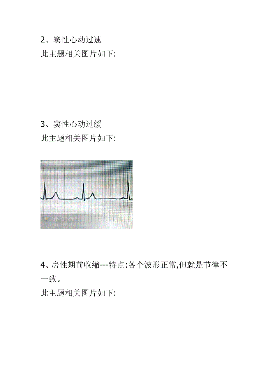 心电图的记忆方法--!收藏着_第4页