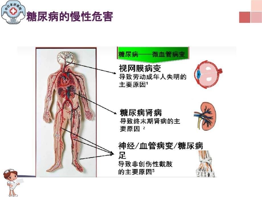 糖尿病的类型及临床表现_第5页