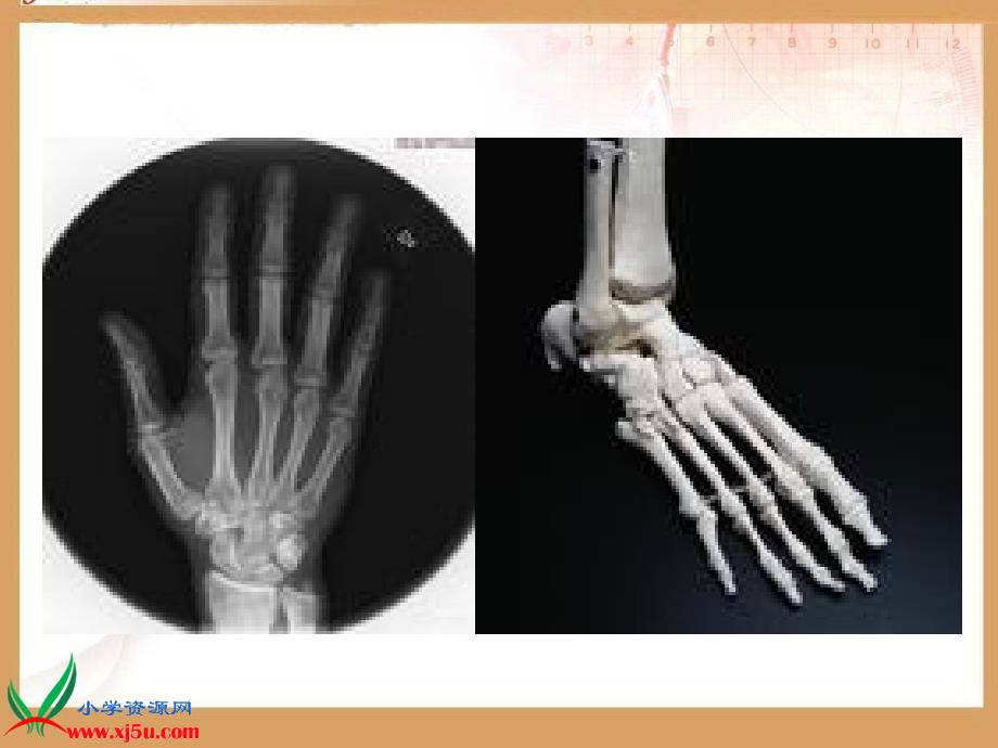 （苏教版）四年级科学下册课件11骨骼(2)_第4页