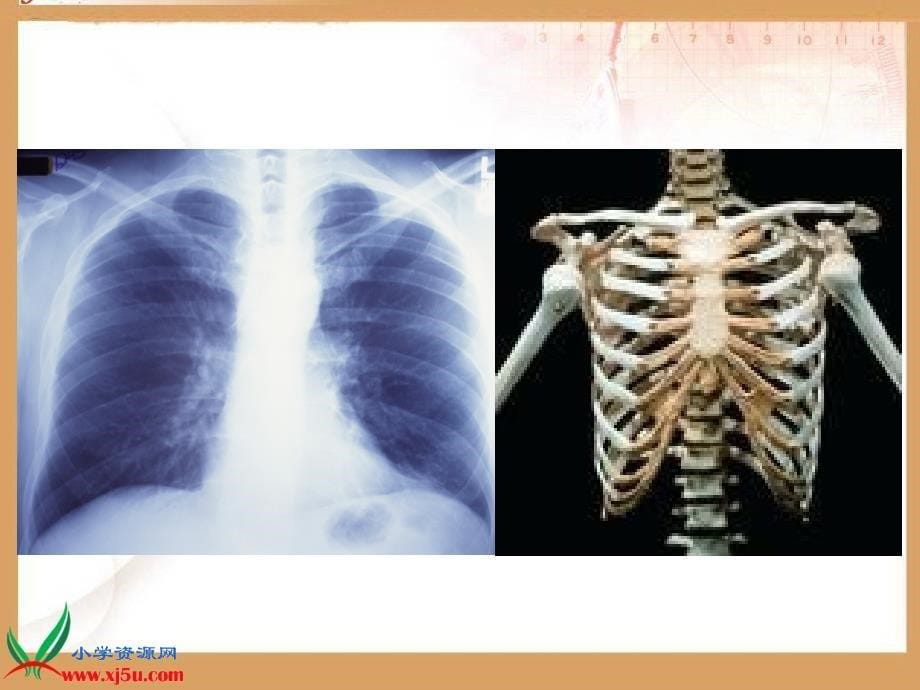 （苏教版）四年级科学下册课件11骨骼(2)_第5页