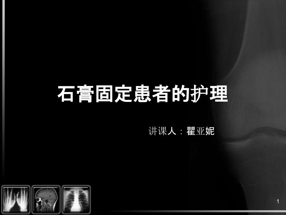 石膏固定患者的护理ppt课件_第1页