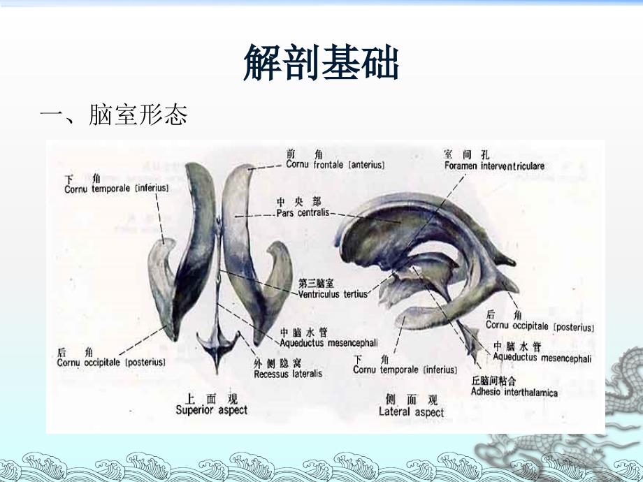 侧脑室穿刺术课件_第2页