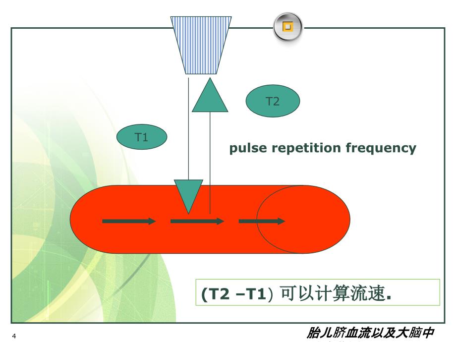 胎儿脐血流以及大脑中动脉监测课件_第4页