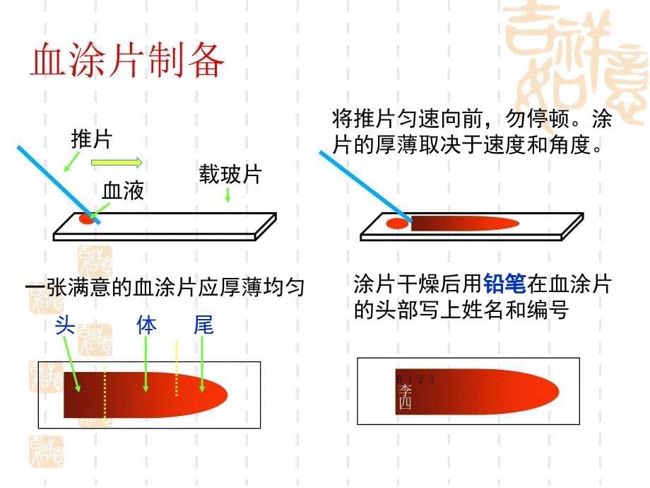 实验网织红细胞计数血沉测定_第5页