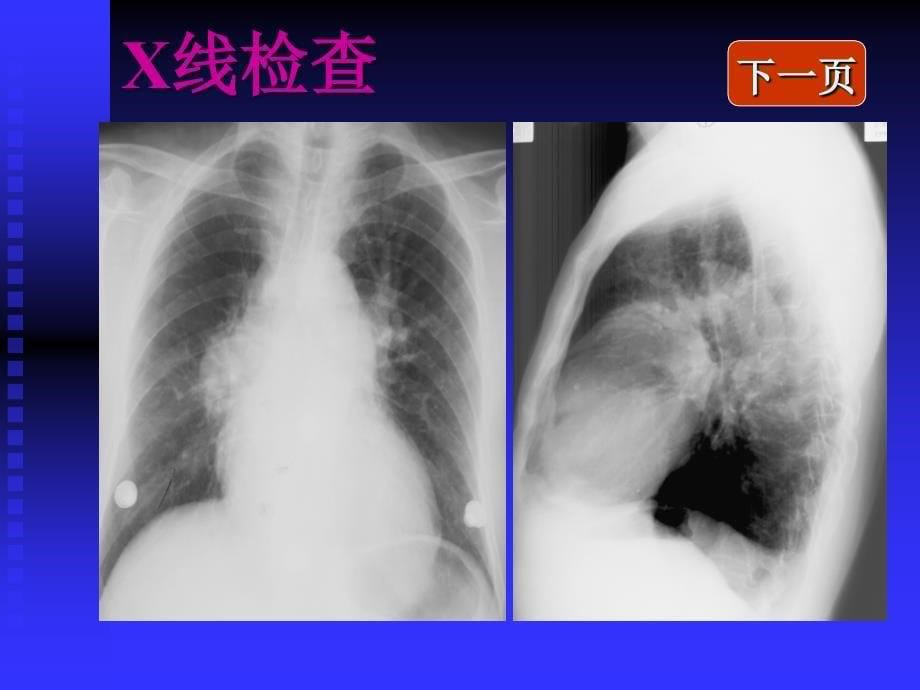 胸部检查临专PPT课件_第5页