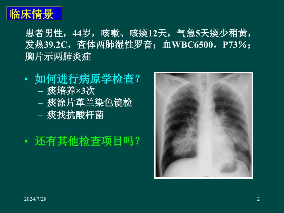 肺部感染诊断难点：病原学诊断的规范化和新技术ppt参考课件_第2页