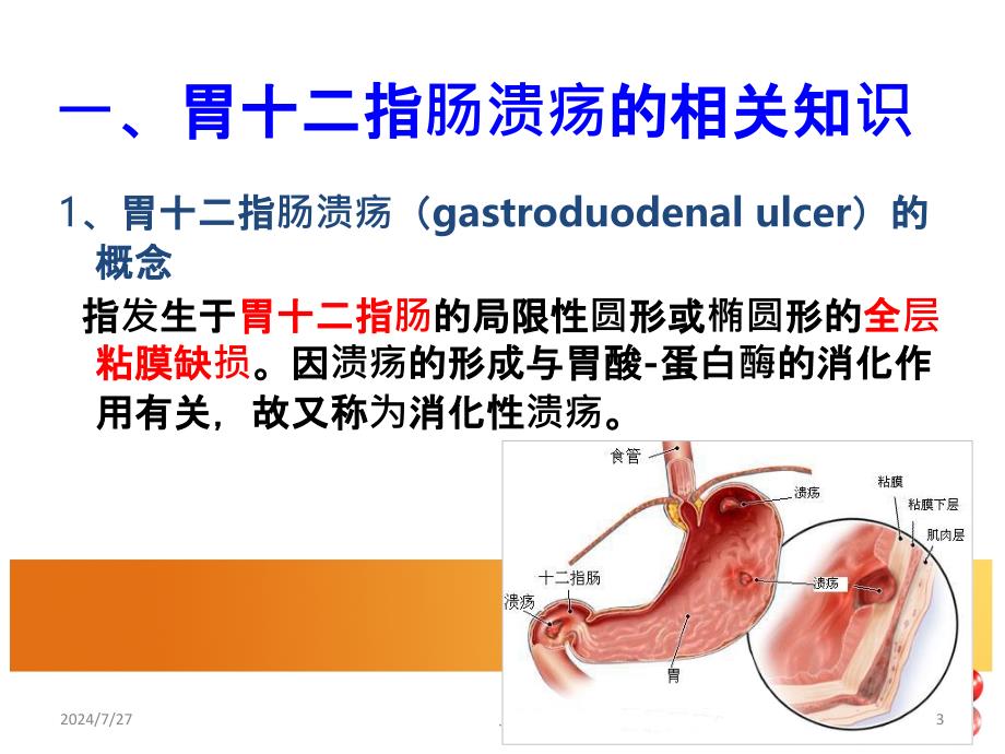 胃十二指肠溃疡病人的护理PPT课件_第3页