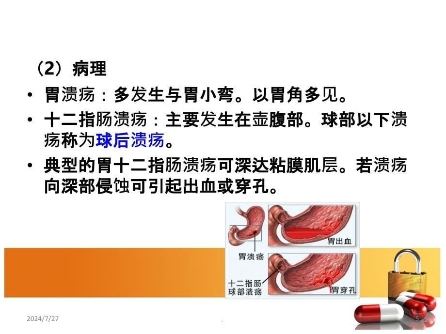 胃十二指肠溃疡病人的护理PPT课件_第5页