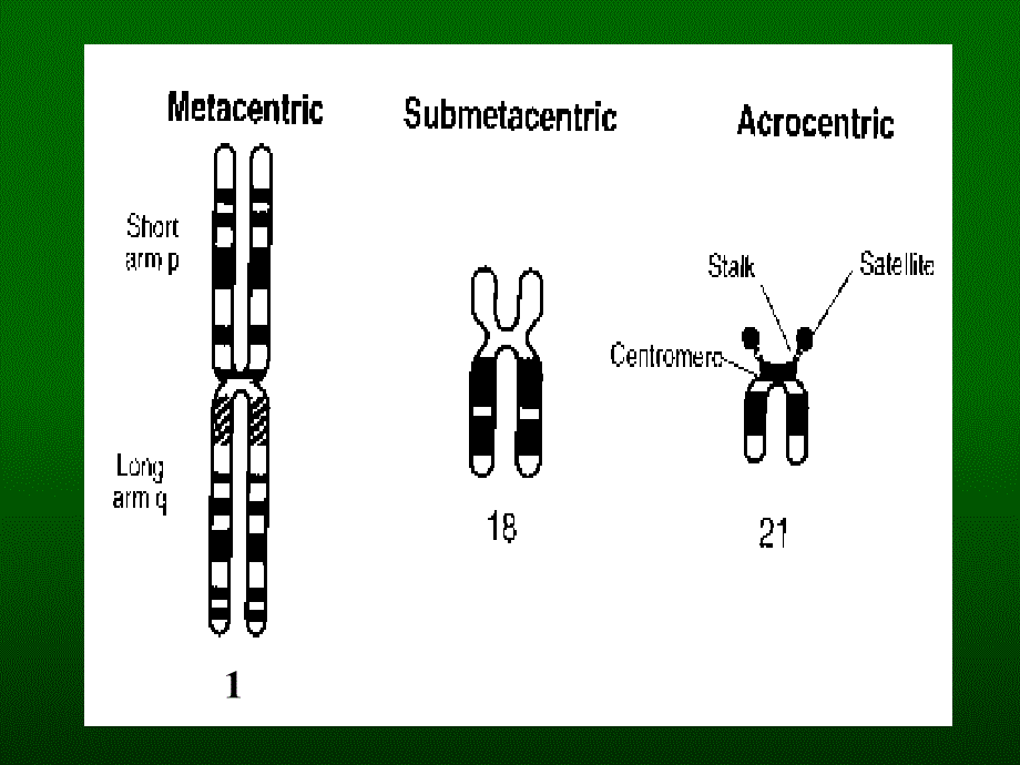 人类正常染色体与染色体畸变课件_第4页