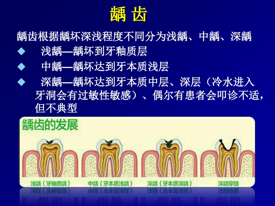 口腔全科常规治疗用物准备杨小辉_第4页