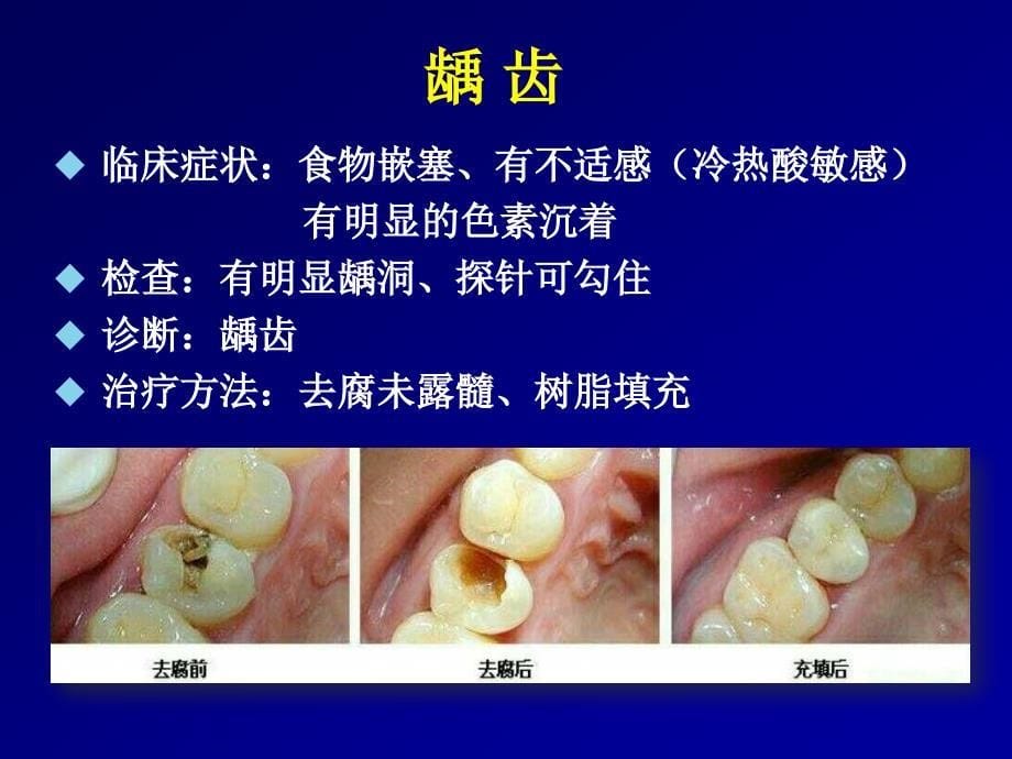 口腔全科常规治疗用物准备杨小辉_第5页