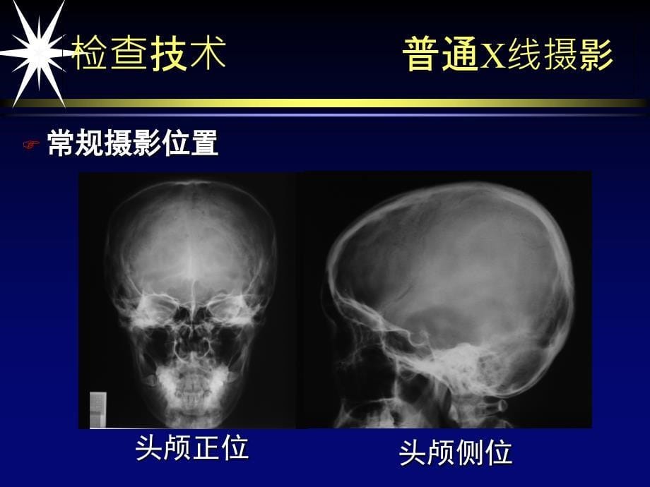 中枢神经系统影像学第一部分 2_第5页