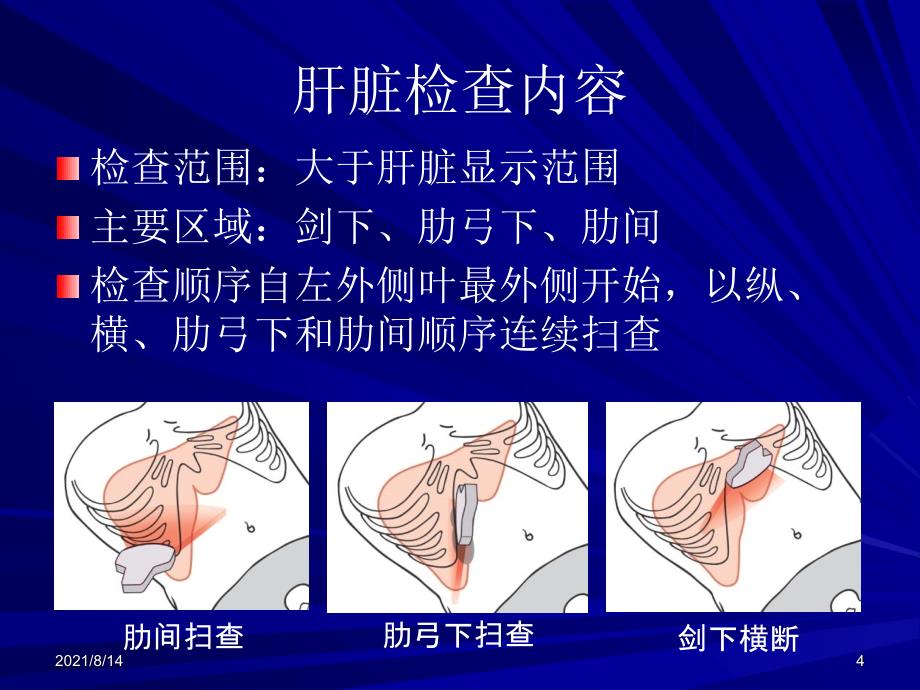 消化系统超声检查_第4页