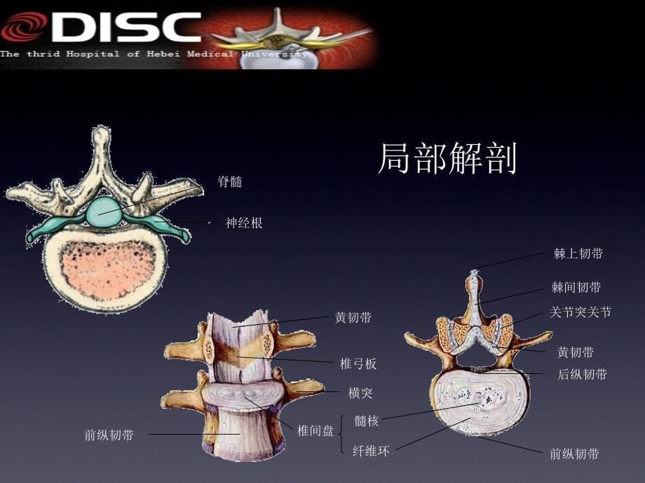 脊柱常见疾病与手术 ppt课件_第5页