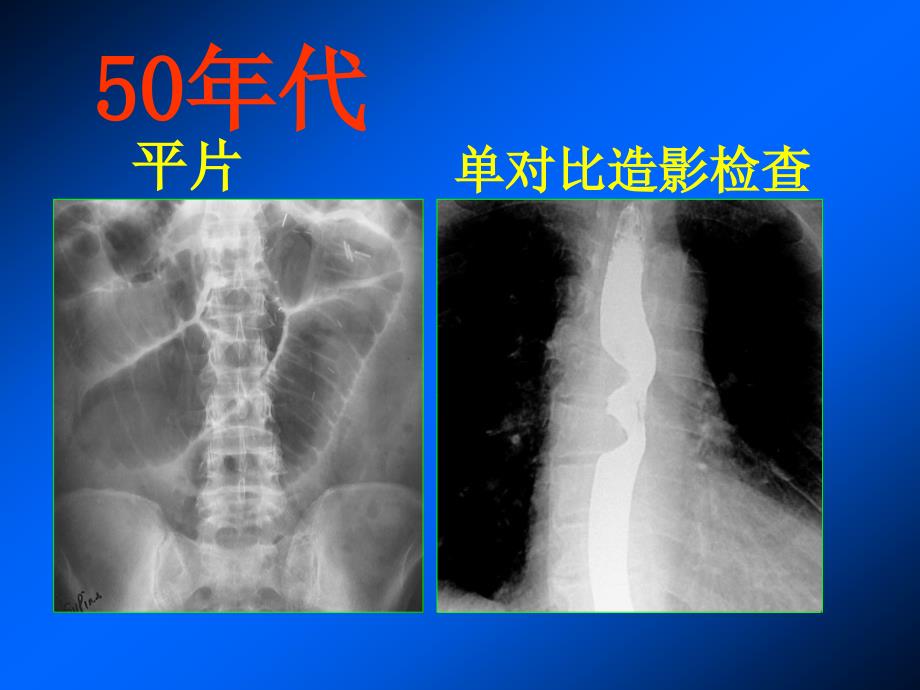 胃肠道影像检查技术的发展PPT课件_第2页