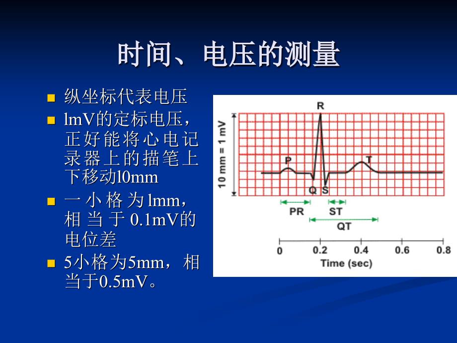 心电图的测量和正常数据_第3页