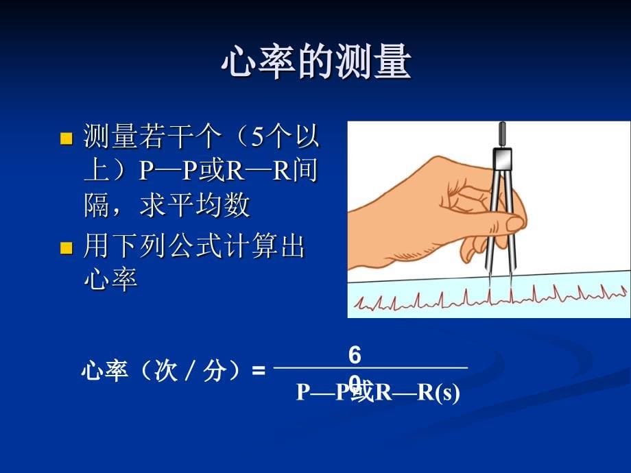 心电图的测量和正常数据_第5页