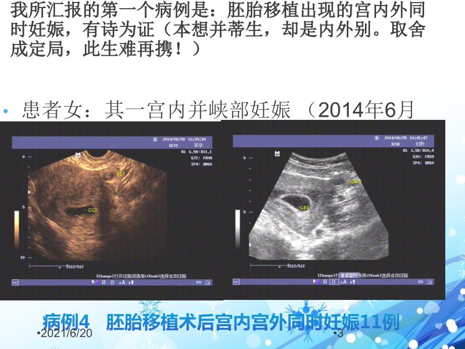 生殖小器官等病例图片（65页_第3页