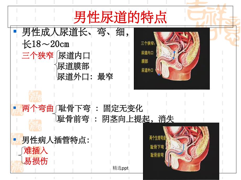 留置导尿技术操作1_第4页