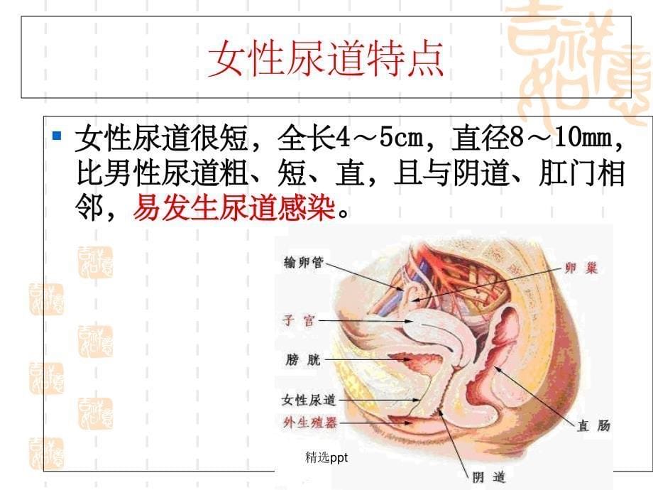 留置导尿技术操作1_第5页