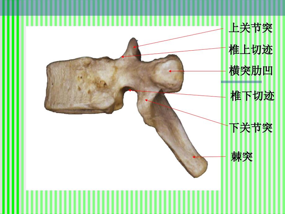 脊柱脊髓应用解剖课件_第3页