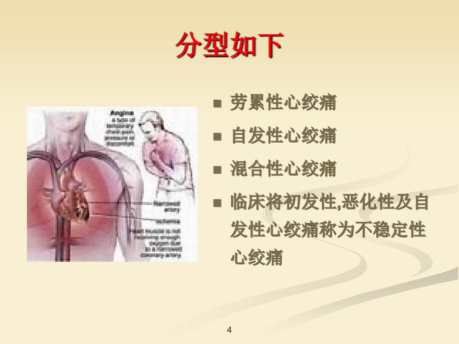 药理学抗心绞痛ppt课件_第4页