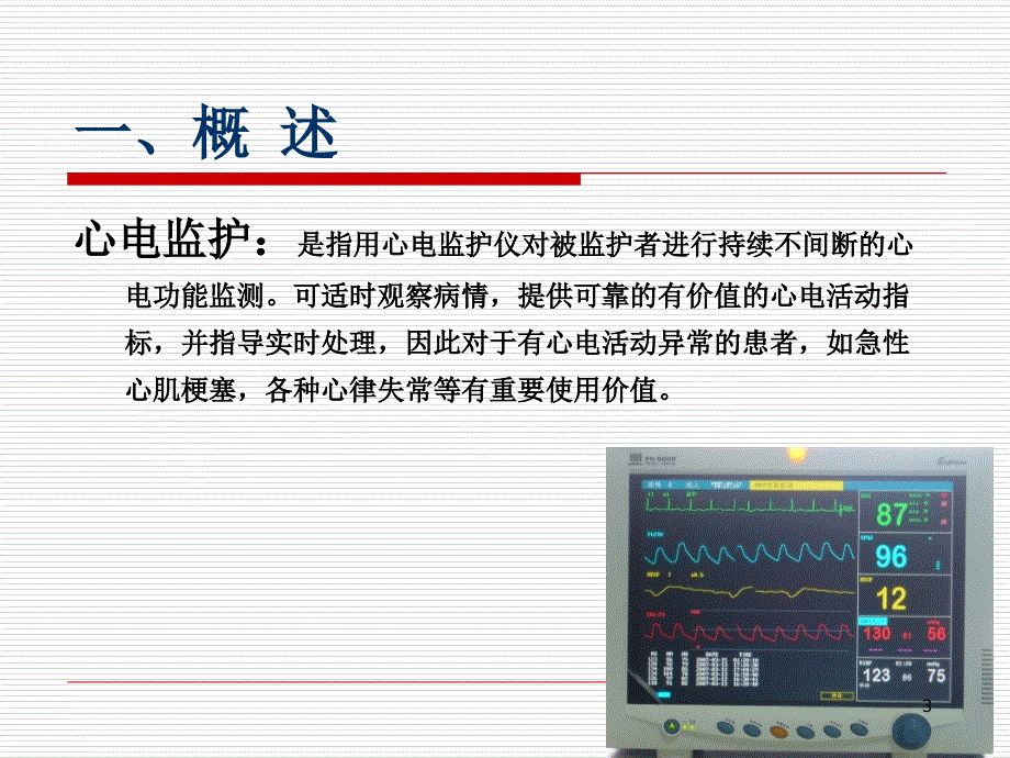 心电监护xuexippt_第3页
