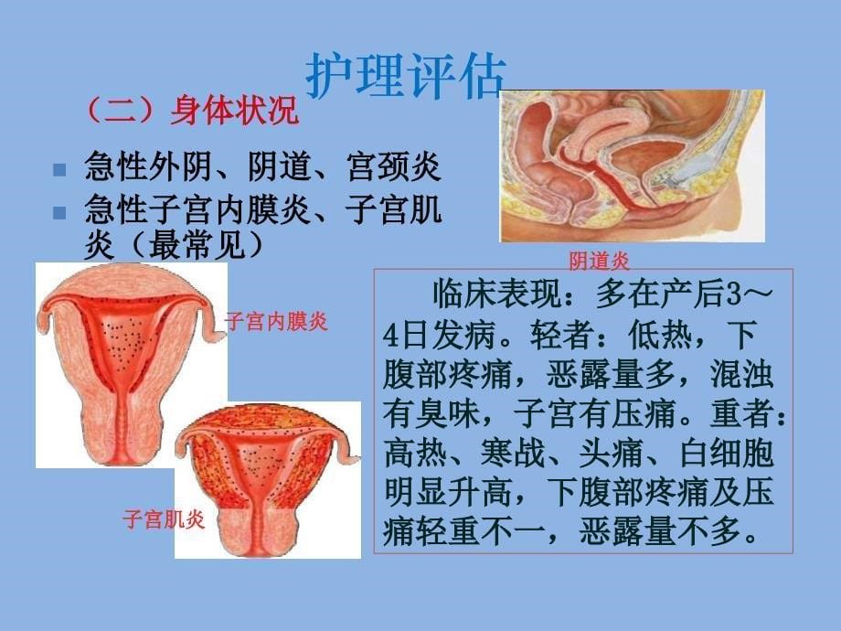 产后并发症妇女的护理产褥感染_第5页